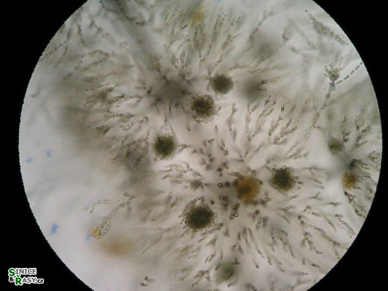 Batrachospermum turfosum