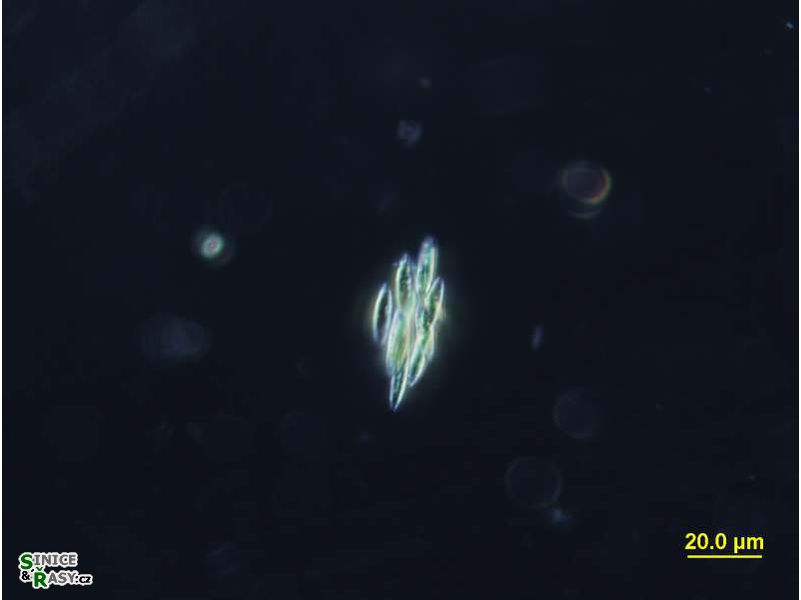 Elakatothrix
