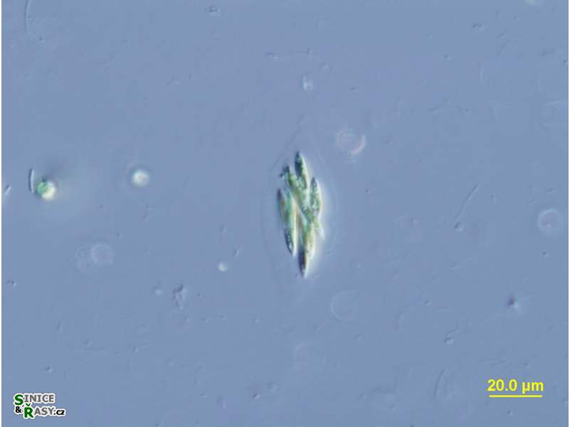 Elakatothrix