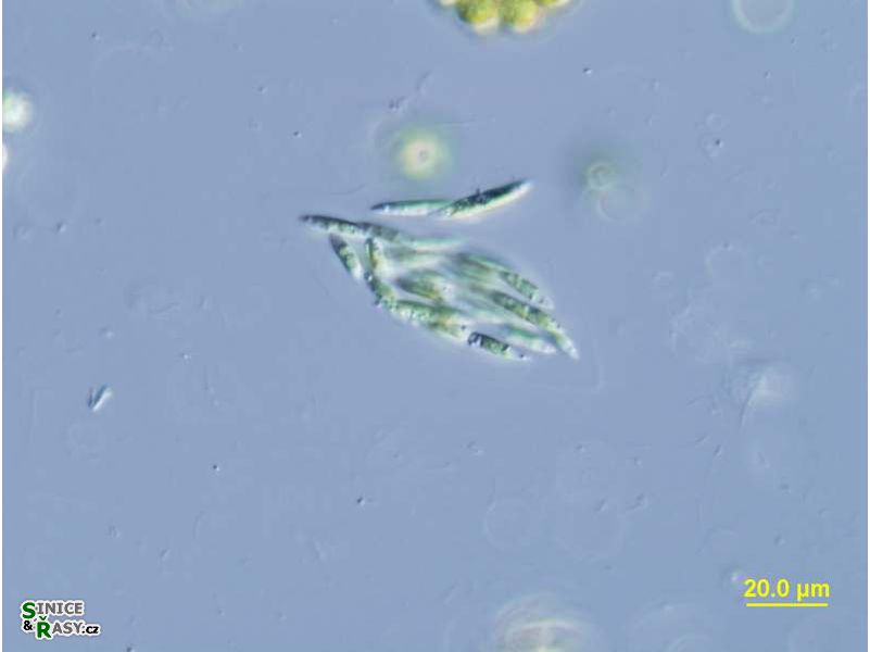 Elakatothrix