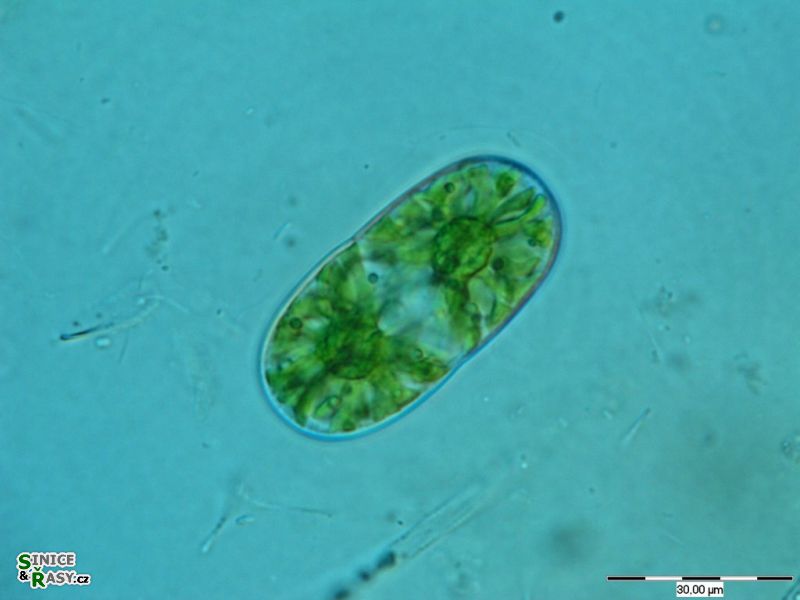Actinotaenium diplosporum