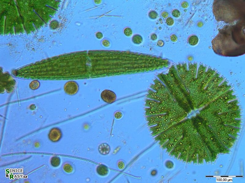 Micrasterias rotata