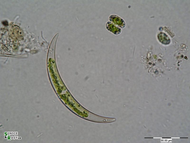 Closterium venus