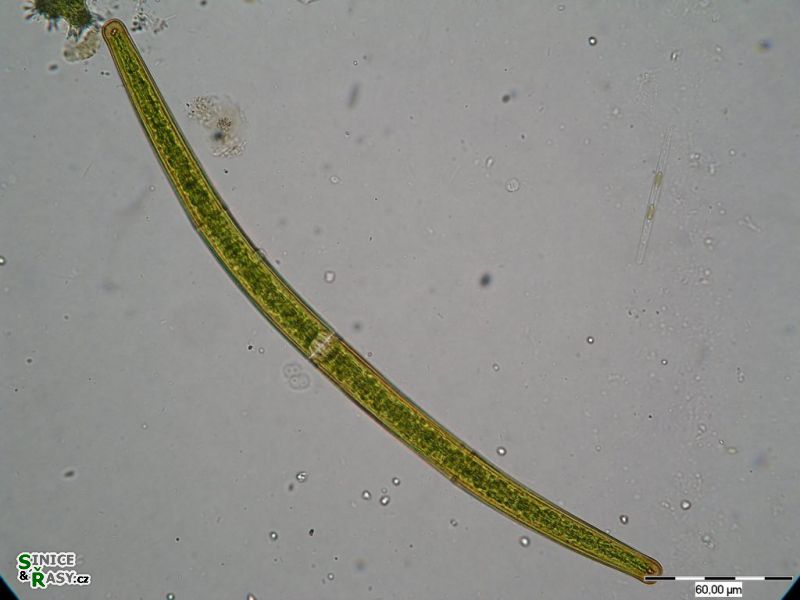 Closterium angustatum