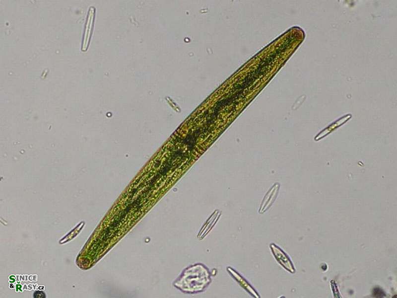 Closterium baillyanum