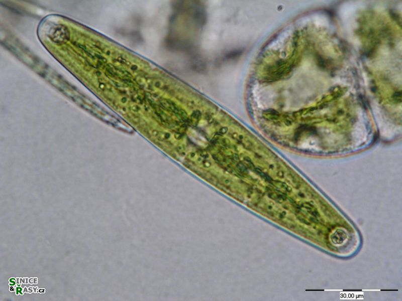 Closterium closterioides