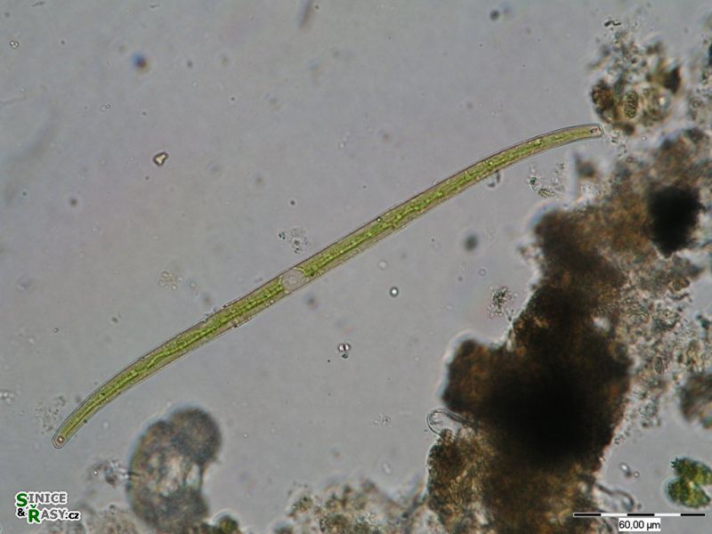 Closterium juncidum