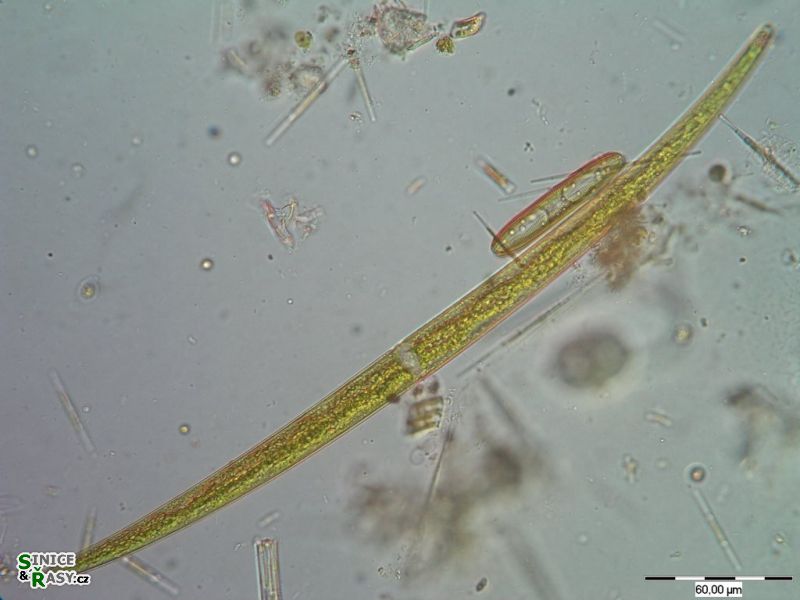 Closterium lineatum