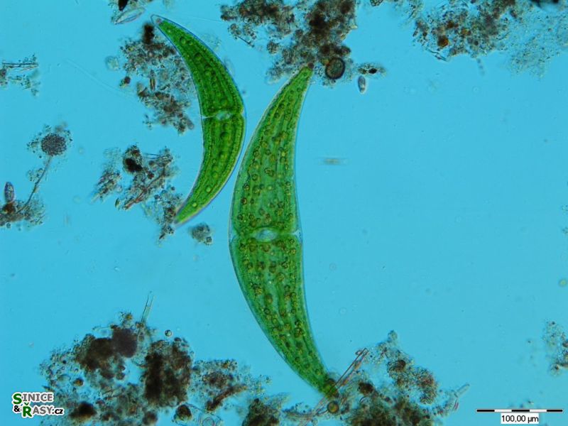 Closterium moniliferum