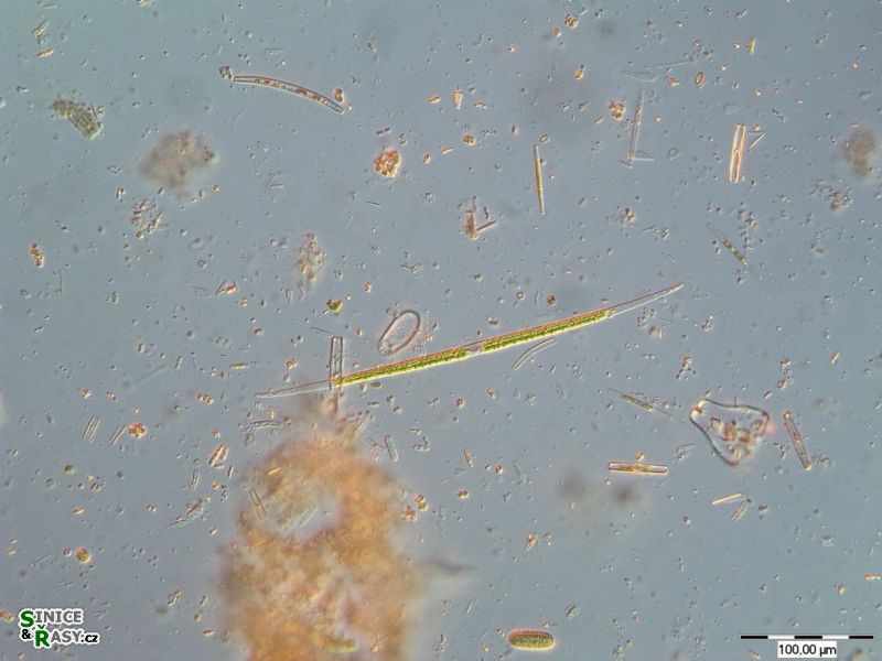 Closterium pronum