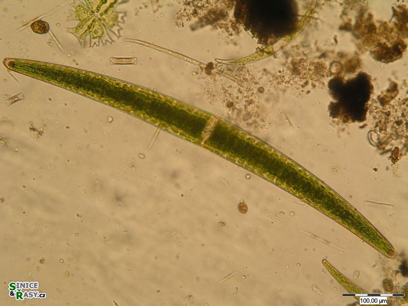 Closterium turgidum