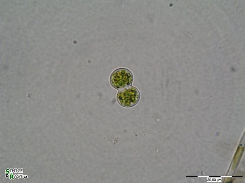 Cosmarium moniliforme