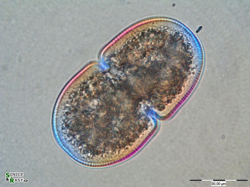 Cosmarium quadratum