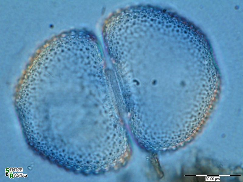 Cosmarium tetraophtalmum