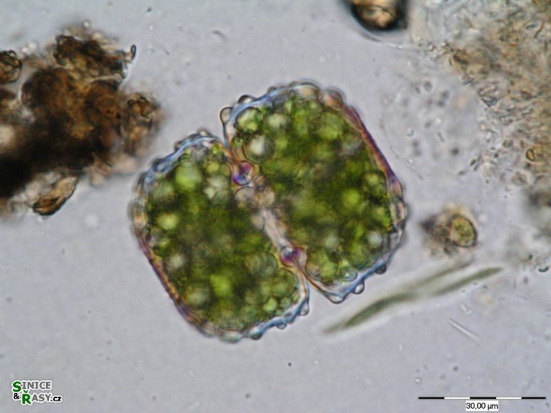 Cosmarium ungerianum
