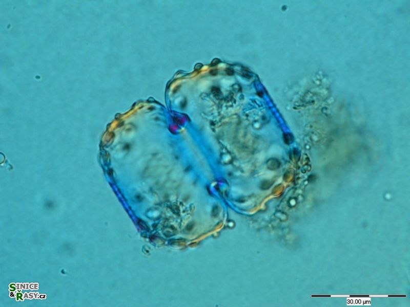 Cosmarium ungerianum