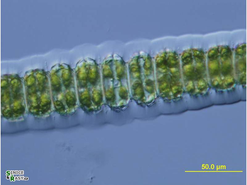 Desmidium cylindricum