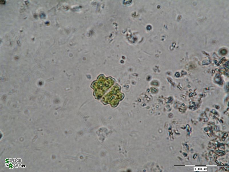 Euastrum binale