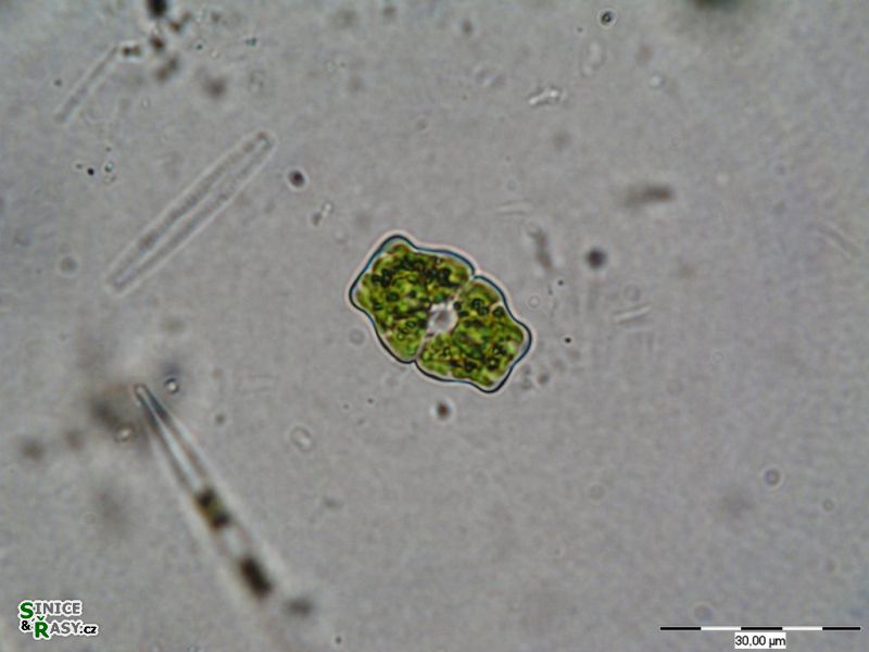 Euastrum luetlemuelleri