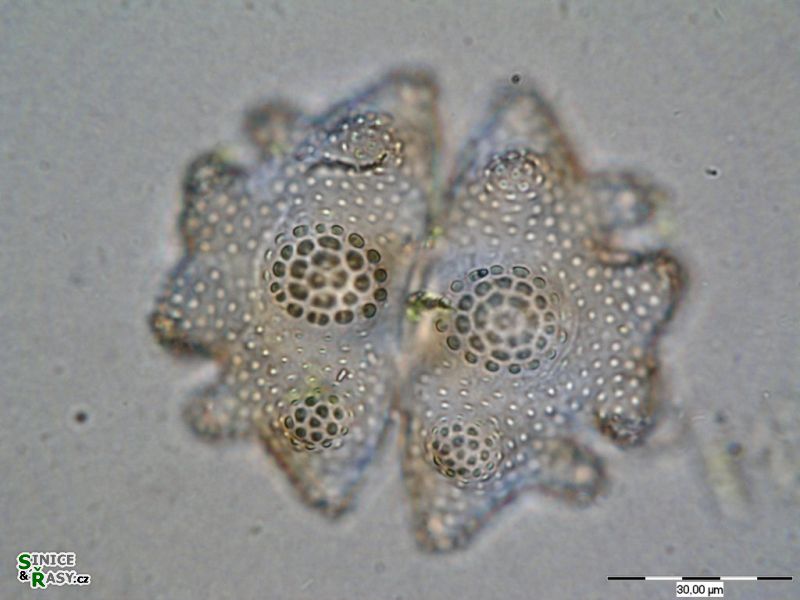Euastrum verrucosum