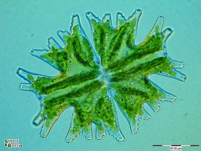 Micrasterias americana