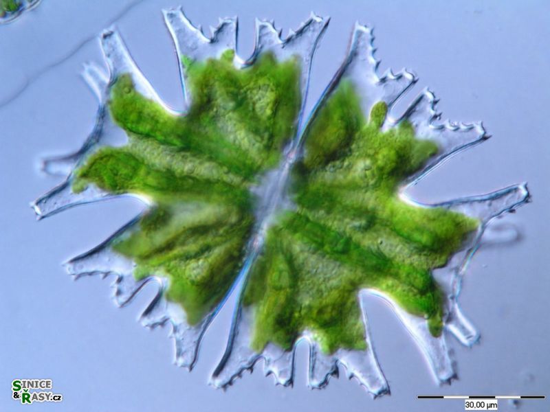 Micrasterias americana