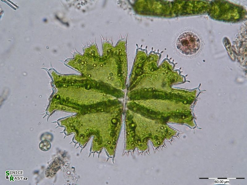 Micrasterias brachyptera