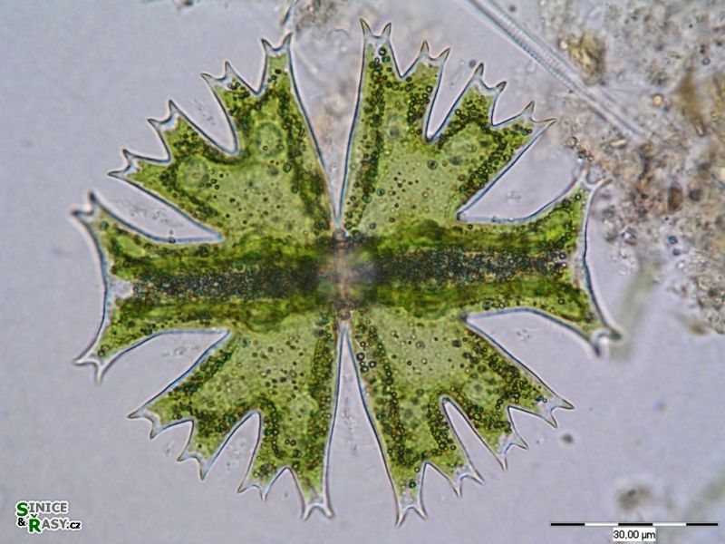 Micrasterias crux-melitensis