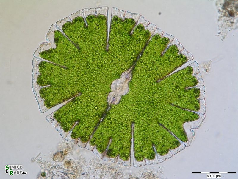 Micrasterias denticulata