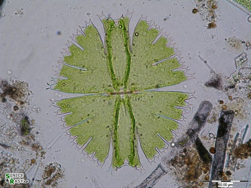 Micrasterias fimbriata