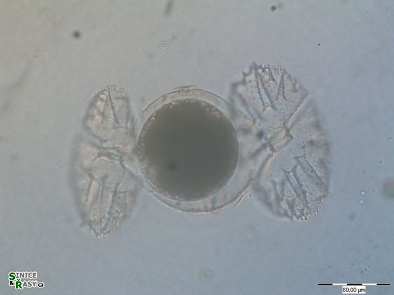 Micrasterias papilifera