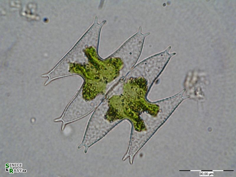 Micrasterias pinnatifida