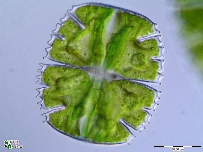 Micrasterias truncata