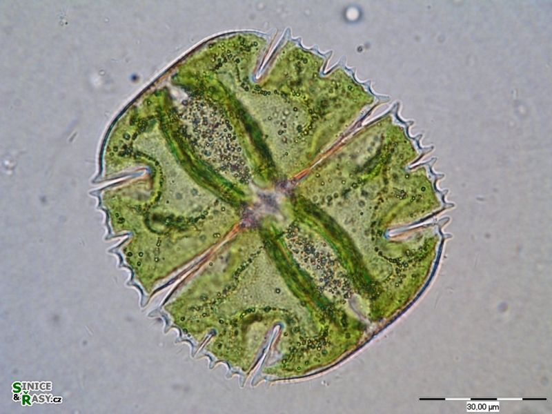 Micrasterias truncata