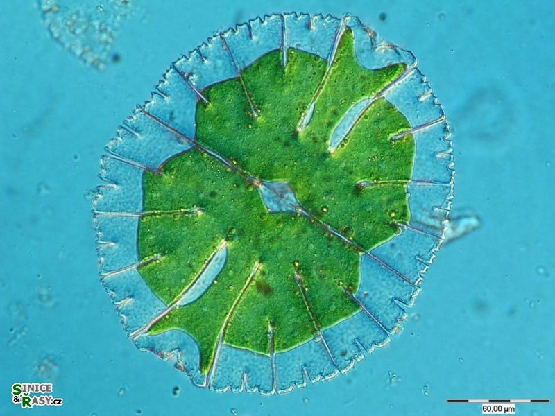 Micrasterias thomasiana