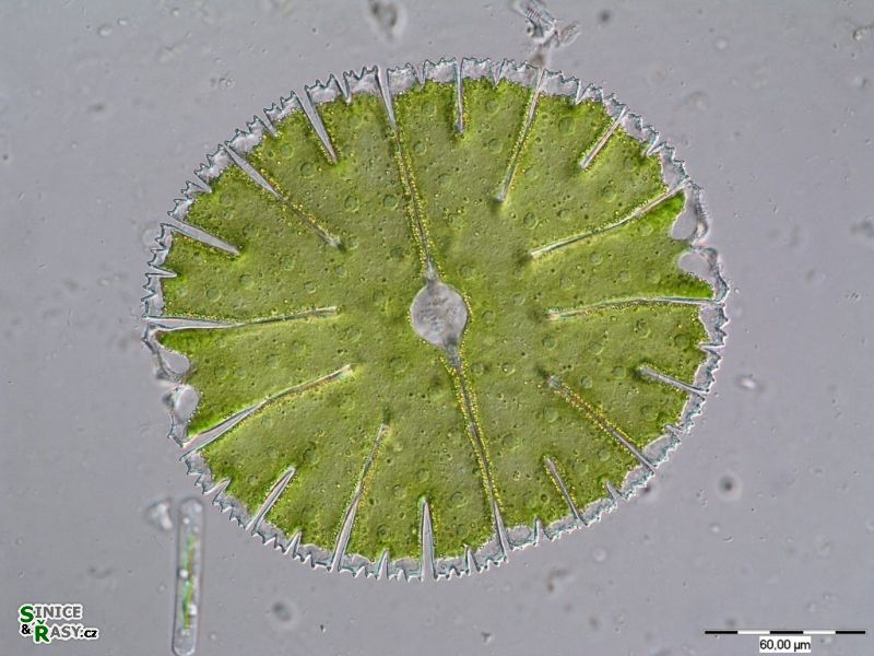 Micrasterias thomasiana