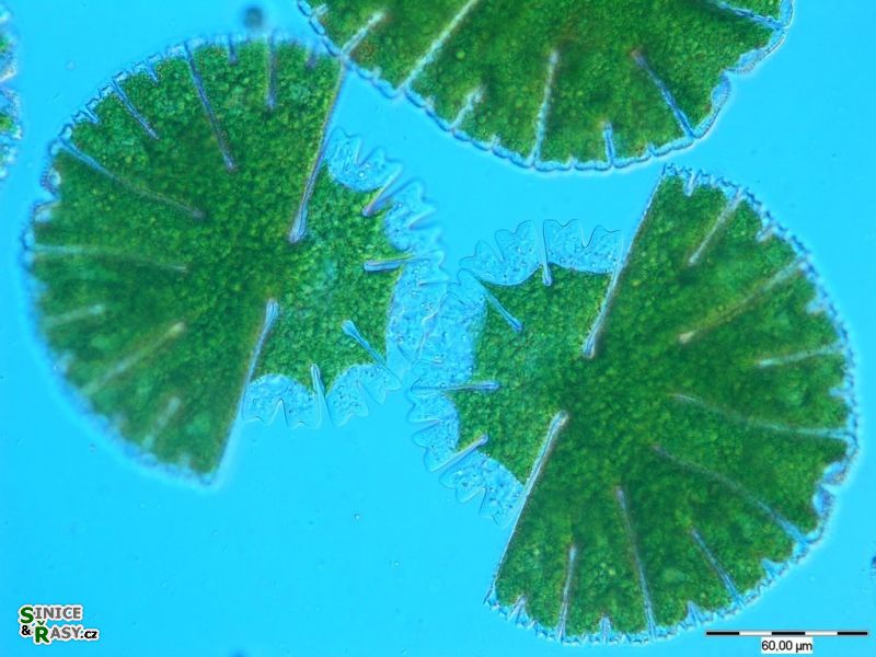 Micrasterias thomasiana