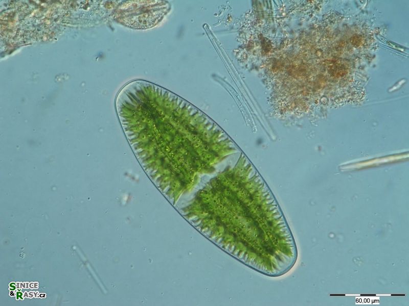 Netrium digitus