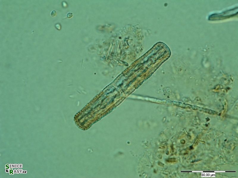 Penium exiquum