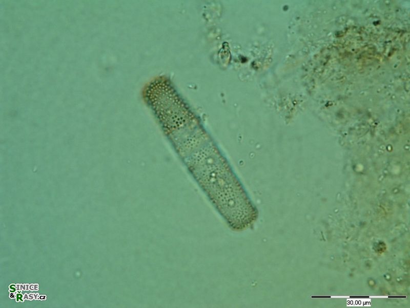 Penium exiquum