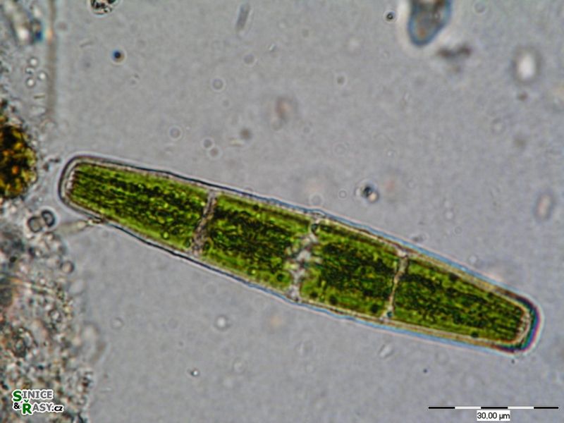 Penium spirostriolatum