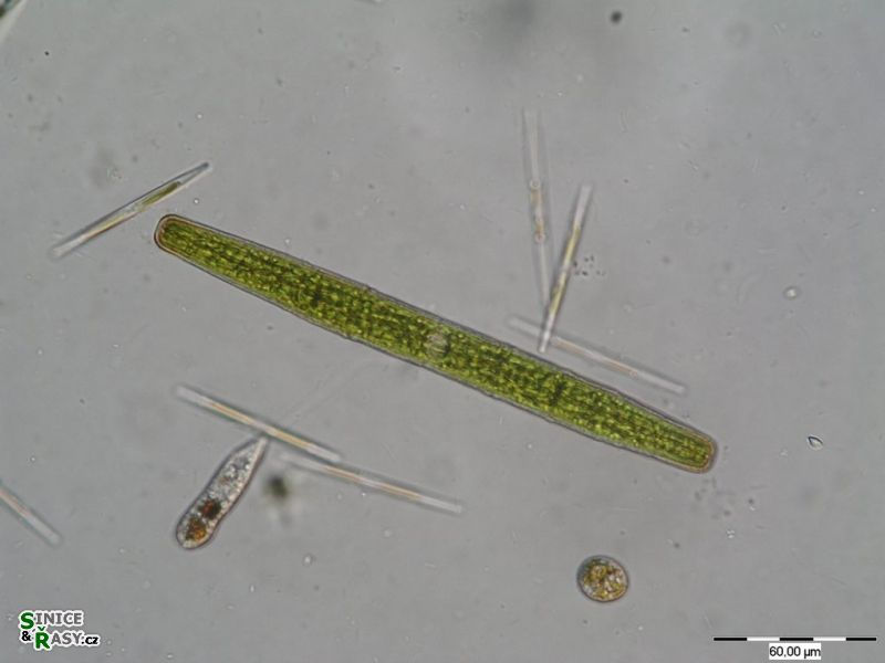 Penium spirostriolatum