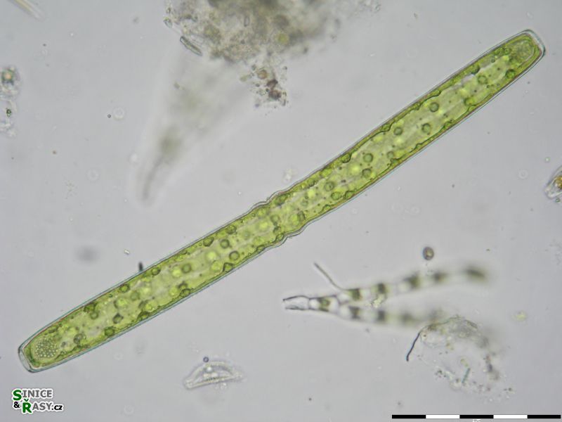 Pleurotaenium