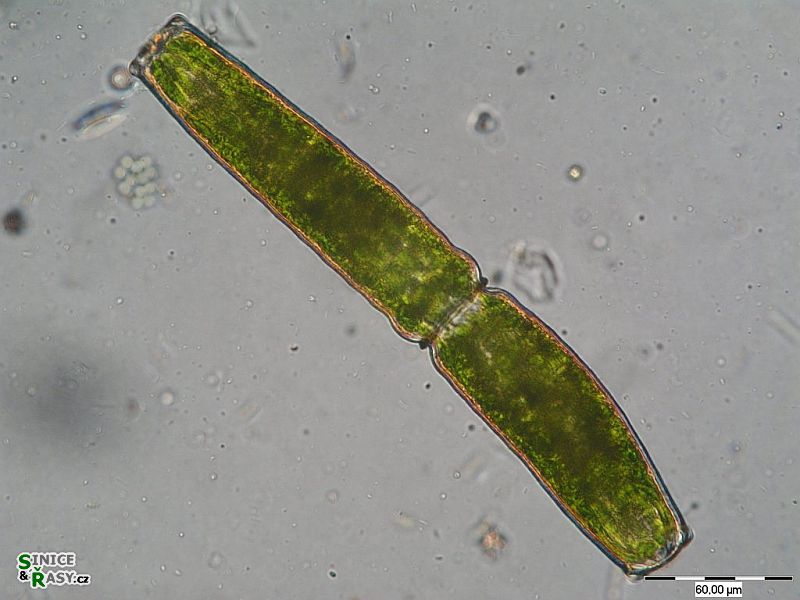 Pleurotaenium coronatum