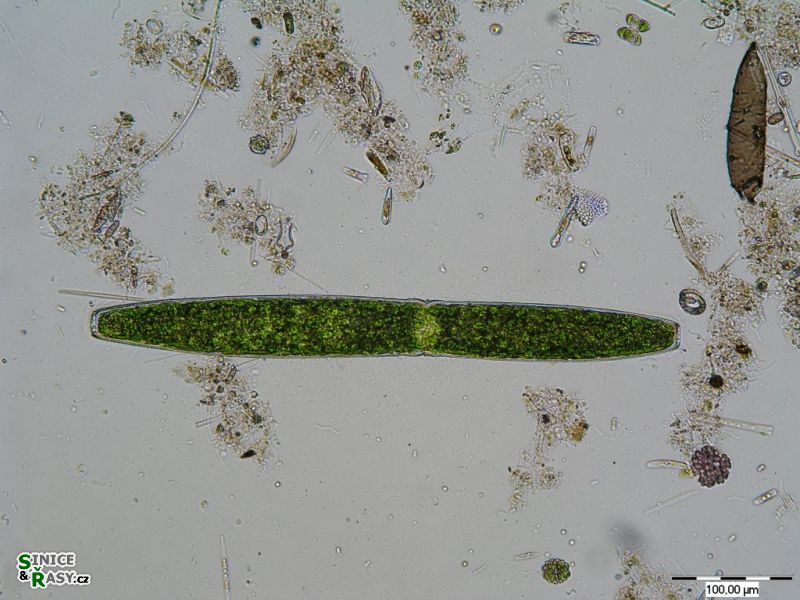 Pleurotaenium crenulatum