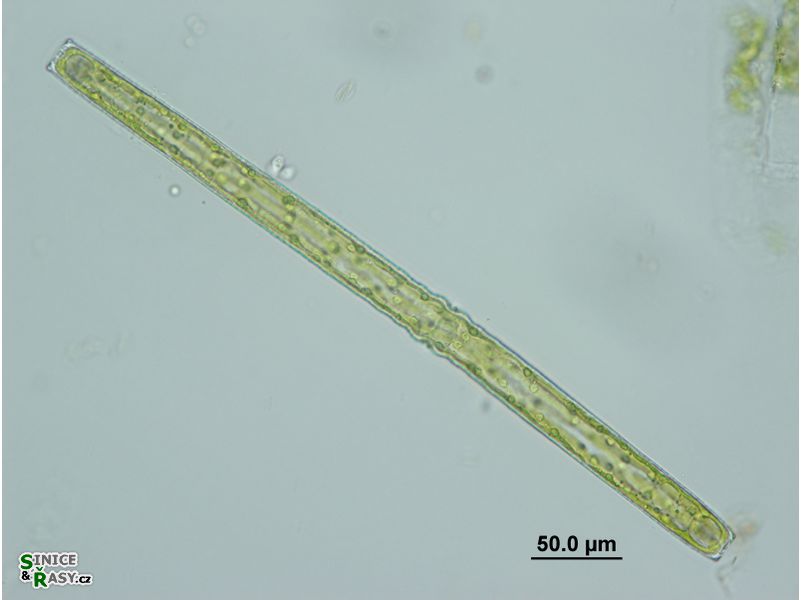 Pleurotaenium ehrenbergii