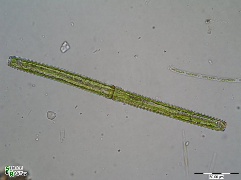 Pleurotaenium ehrenbergii