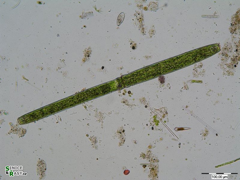 Pleurotaenium nodulosum