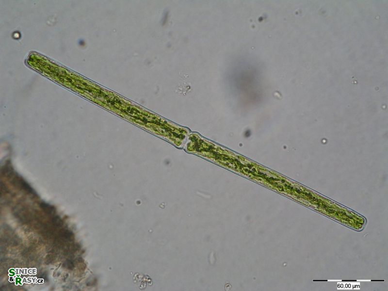 Pleurotaenium rectum