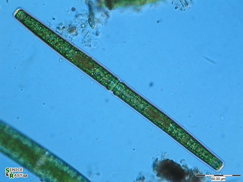 Pleurotaenium rectum